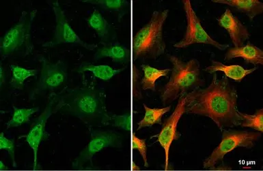 Anti-Nurr1 antibody used in Immunocytochemistry/ Immunofluorescence (ICC/IF). GTX114045