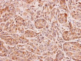 Anti-NAT2 antibody [N1C2] used in IHC (Paraffin sections) (IHC-P). GTX114051