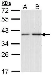 Anti-NAT2 antibody [N1C2] used in Western Blot (WB). GTX114051