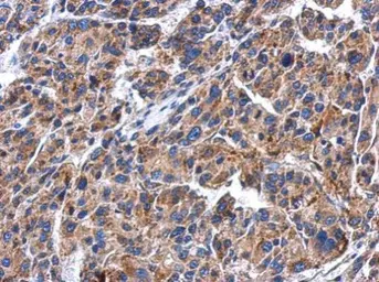 Anti-GBA antibody used in IHC (Paraffin sections) (IHC-P). GTX114073