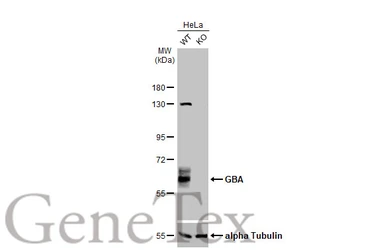 Anti-GBA antibody used in Western Blot (WB). GTX114073