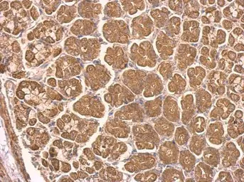 Anti-NDUFS8 antibody used in IHC (Paraffin sections) (IHC-P). GTX114119