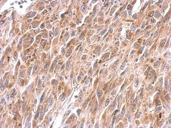 Anti-NDUFS8 antibody used in IHC (Paraffin sections) (IHC-P). GTX114119