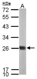 Anti-NDUFS8 antibody used in Western Blot (WB). GTX114119