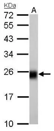 Anti-NDUFS8 antibody used in Western Blot (WB). GTX114119