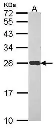 Anti-NDUFS8 antibody used in Western Blot (WB). GTX114119