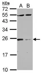 Anti-14-3-3 zeta antibody used in Western Blot (WB). GTX114140