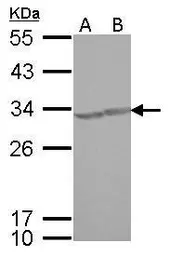 Anti-CREM antibody used in Western Blot (WB). GTX114146