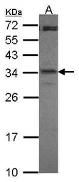 Anti-CREM antibody used in Western Blot (WB). GTX114146