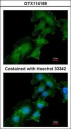 Anti-Renin Receptor antibody [N3C3] used in Immunocytochemistry/ Immunofluorescence (ICC/IF). GTX114169