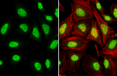 Anti-TDP43 antibody used in Immunocytochemistry/ Immunofluorescence (ICC/IF). GTX114210