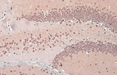 Anti-TDP43 antibody used in IHC (Paraffin sections) (IHC-P). GTX114210