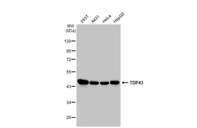 Anti-TDP43 antibody used in Western Blot (WB). GTX114210