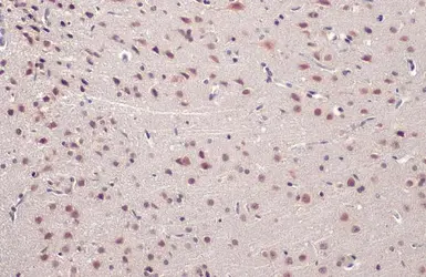 Anti-TDP43 antibody used in IHC (Paraffin sections) (IHC-P). GTX114210