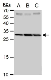 Anti-SLC25A6 antibody used in Western Blot (WB). GTX114252