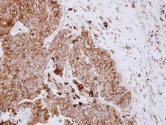 Anti-ASAH1 antibody used in IHC (Paraffin sections) (IHC-P). GTX114267