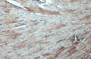 Anti-ASAH1 antibody used in IHC (Paraffin sections) (IHC-P). GTX114267