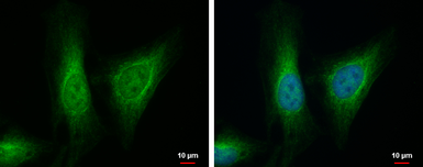 Anti-ALDH7A1 antibody [C1C3] used in Immunocytochemistry/ Immunofluorescence (ICC/IF). GTX114274