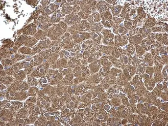 Anti-ALDH7A1 antibody [C1C3] used in IHC (Paraffin sections) (IHC-P). GTX114274