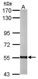 Anti-ALDH7A1 antibody [C1C3] used in Western Blot (WB). GTX114274