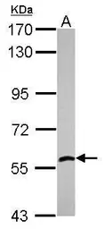 Anti-ALDH7A1 antibody [C1C3] used in Western Blot (WB). GTX114274