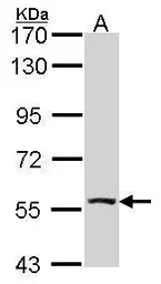 Anti-ALDH7A1 antibody [C1C3] used in Western Blot (WB). GTX114274