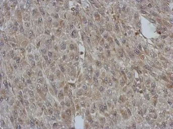 Anti-BNIP2 antibody used in IHC (Paraffin sections) (IHC-P). GTX114283