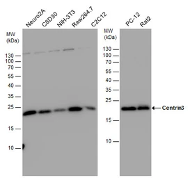 Anti-Centrin 3 antibody used in Western Blot (WB). GTX114317