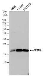Anti-Centrin 3 antibody used in Western Blot (WB). GTX114317