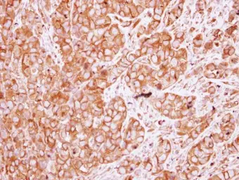 Anti-AChR beta 1 antibody [C1C3] used in IHC (Paraffin sections) (IHC-P). GTX114323