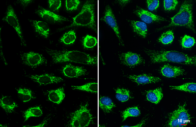 Anti-COX4 antibody used in Immunocytochemistry/ Immunofluorescence (ICC/IF). GTX114330