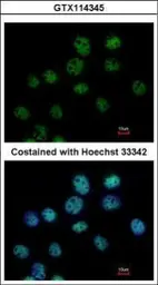 Anti-cleavage stimulation factor antibody [N1C1] used in Immunocytochemistry/ Immunofluorescence (ICC/IF). GTX114345