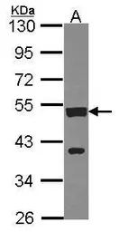 Anti-cleavage stimulation factor antibody [N1C1] used in Western Blot (WB). GTX114345