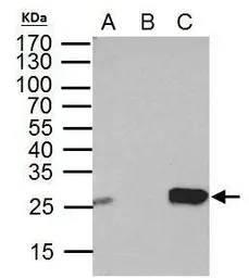 Anti-DTYMK antibody used in Immunoprecipitation (IP). GTX114371