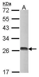 Anti-DTYMK antibody used in Western Blot (WB). GTX114371