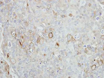 Anti-Stomatin antibody [N2C3] used in IHC (Paraffin sections) (IHC-P). GTX114389