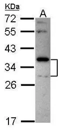 Anti-Stomatin antibody [N2C3] used in Western Blot (WB). GTX114389