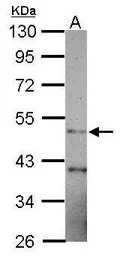 Anti-GATM antibody [N3C3] used in Western Blot (WB). GTX114423