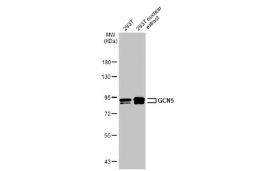 Anti-GCN5 antibody [C2C3], C-term used in Western Blot (WB). GTX114428