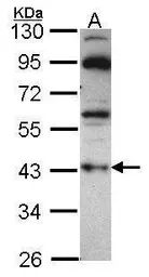 Anti-GNAZ antibody [N1C1] used in Western Blot (WB). GTX114441