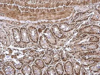 Anti-CSN1 antibody used in IHC (Paraffin sections) (IHC-P). GTX114450