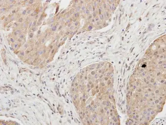 Anti-Granzyme A antibody [N2C3] used in IHC (Paraffin sections) (IHC-P). GTX114461