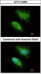 Anti-HIP2 antibody used in Immunocytochemistry/ Immunofluorescence (ICC/IF). GTX114469