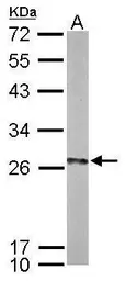 Anti-HIP2 antibody used in Western Blot (WB). GTX114469