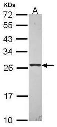 Anti-HIP2 antibody used in Western Blot (WB). GTX114469