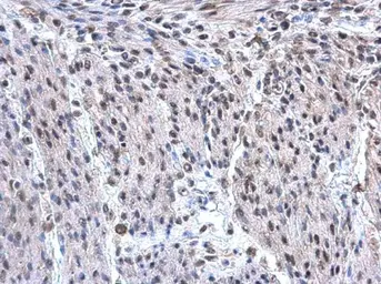 Anti-hnRNP F antibody [N1N3] used in IHC (Paraffin sections) (IHC-P). GTX114476