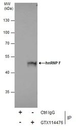 Anti-hnRNP F antibody [N1N3] used in Immunoprecipitation (IP). GTX114476