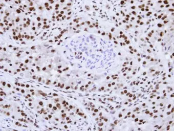 Anti-hnRNP F antibody [N1N3] used in IHC (Paraffin sections) (IHC-P). GTX114476