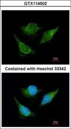 Anti-IVD antibody used in Immunocytochemistry/ Immunofluorescence (ICC/IF). GTX114502