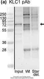 Anti-KLC1 antibody [N2C2], Internal used in Western Blot (WB). GTX114510